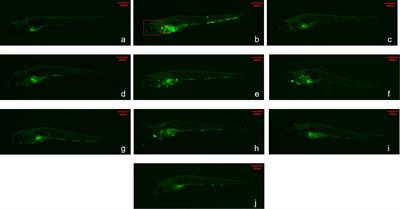 Antibacterial activity of the novel oxazolidinone contezolid (MRX-I) against Mycobacterium abscessus